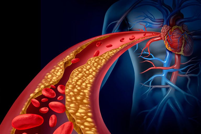 7 Alimentos Para Controlar o Colesterol: Melhore o HDL e Reduza o LDL Naturalmente